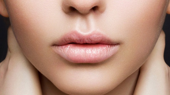 header_image_How-to-get-rid-of-cracked-lips-AR-Fustany-Main-Image