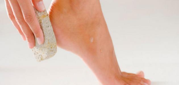 الحجر الجاف لعلاج تشقق القدمين