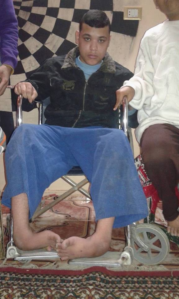 أحد الأبناء المصابين بالشلل أحد الأبناء المصابين بالشلل