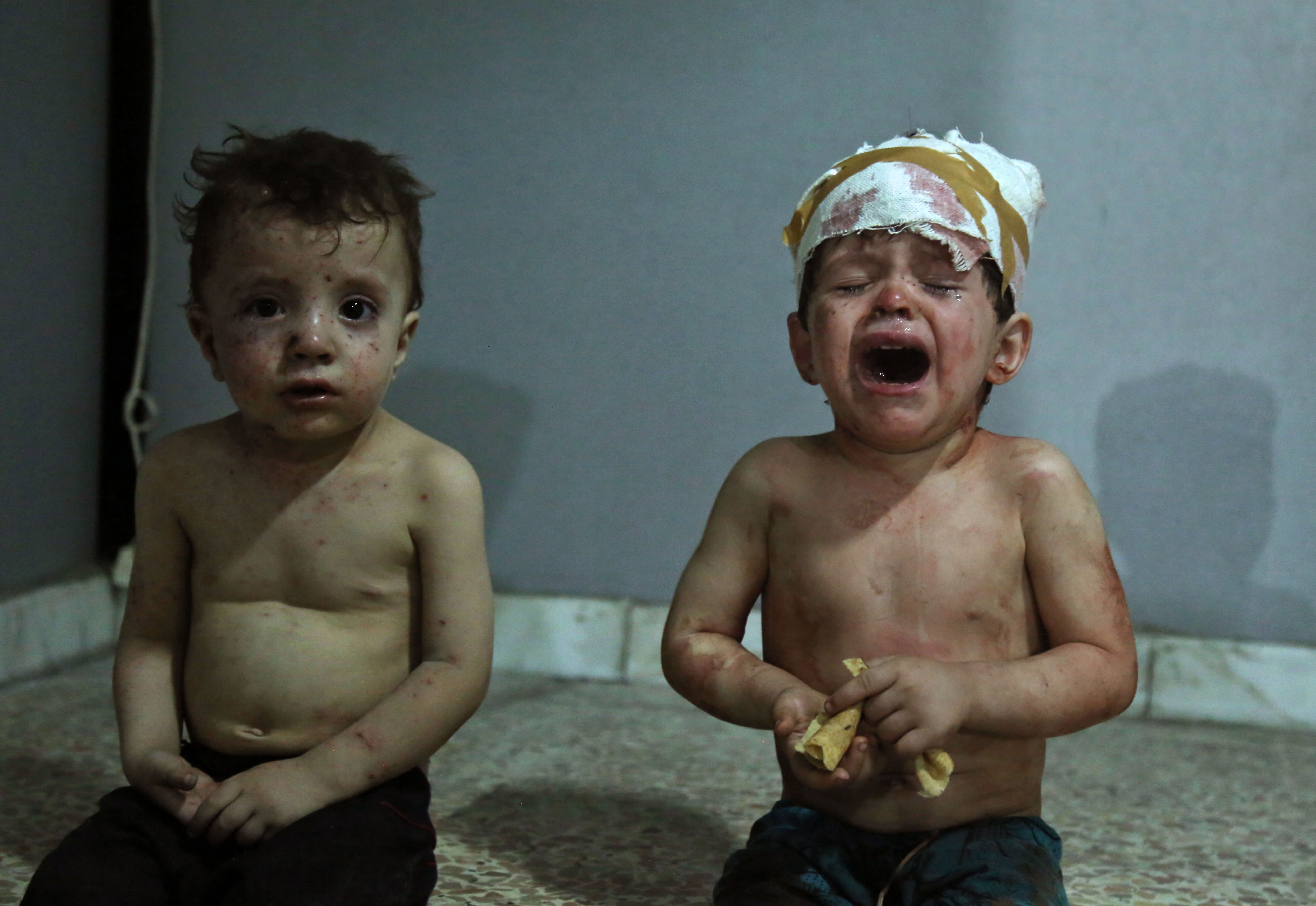 طفل سوري يبكى بعد إصابته في غارة جوية