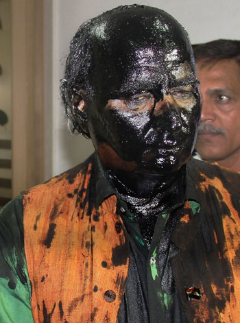 الناشط الهندى سودهيندرا كولكارنى بعد أن قام نشطاء حزب 