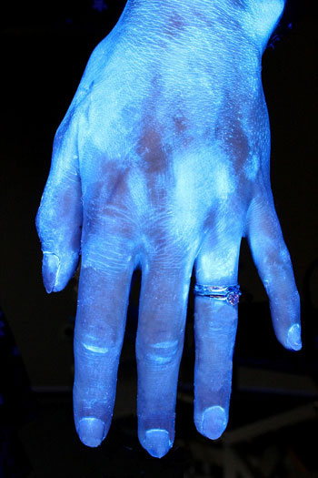 شكل اليد بعد غسلها لمدة 6 ثوانى بالمياه فقط دون استخدام الصابون -اليوم السابع -10 -2015