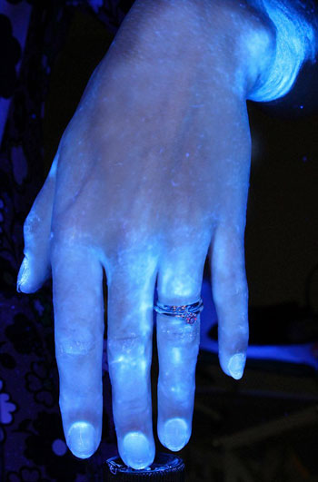 صورة توضح شكل اليد بعد غسلها لمدة 6 ثوانى بالمياه والصابون -اليوم السابع -10 -2015