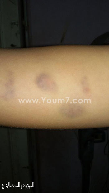 اليوم السابع -10 -2015