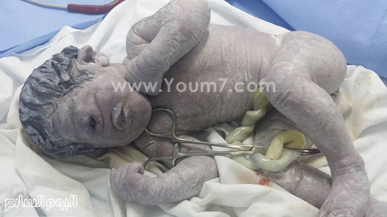 اليوم السابع -10 -2015