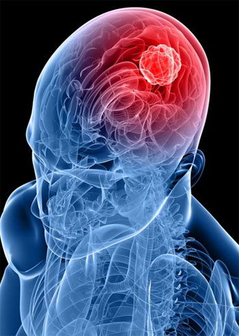 يستخدم دماغك حوالى 20٪ من إجمالى الأوكسجين والدم فى الموجود فى الجسم. -اليوم السابع -10 -2015