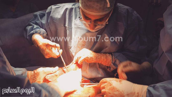 صورة لفتح البطن أثناء عملية استئصال أكبر ورم ليفى فى العالم -اليوم السابع -12 -2015