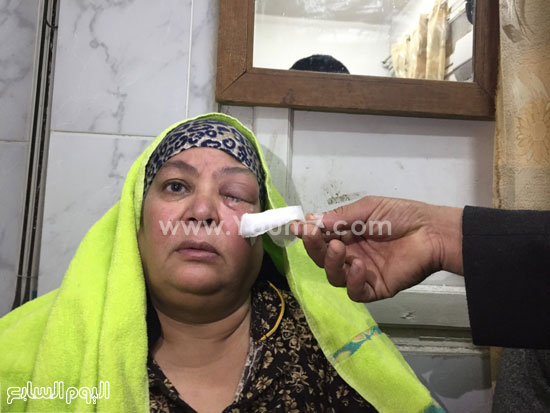 ضحايا الإهمال بمستشفى رمد طنطا (8)