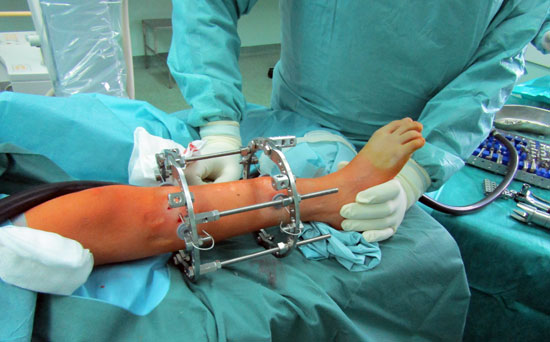 قافلة الأزهر تجرى عمليات جراحية داخل أكبر مستشفى جامعى بسراييفو  (3)