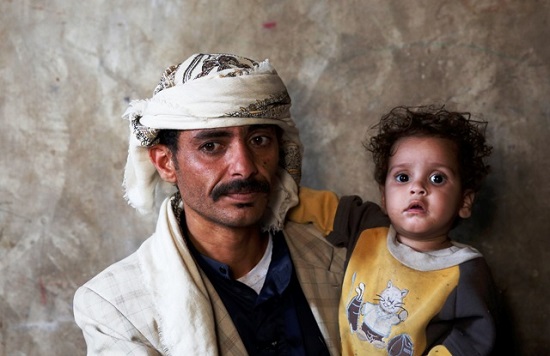 الجوع فى اليمن  (4)