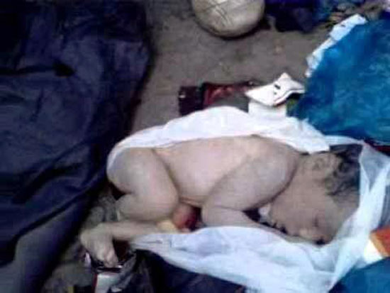 طفل عثر عليه بصندوق قمامة بالفيوم فى حضانة بمستشفى إبشواى (1)