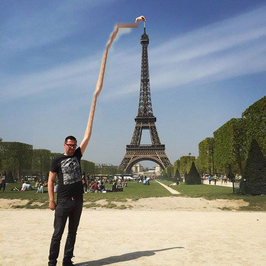 	أطول ذراع فى العالم  -اليوم السابع -4 -2015