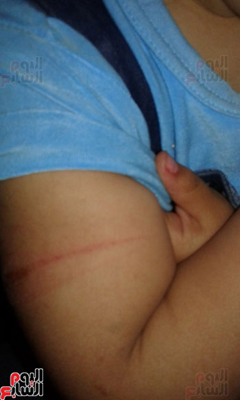اتهام مدرسة بالتعدى على طفلة بـخرطوم وإصابتها بكدمات فى جسدها بالدقهلية (1)
