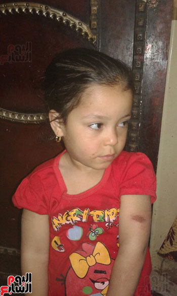 اتهام مدرسة بالتعدى على طفلة بـخرطوم وإصابتها بكدمات فى جسدها بالدقهلية (6)