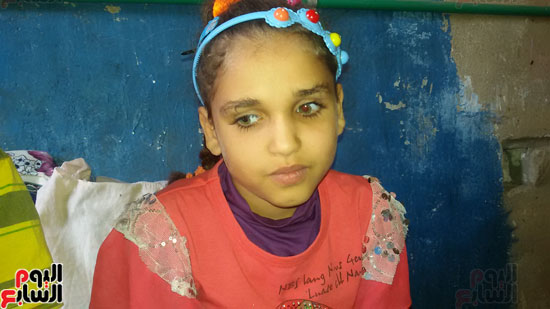 بنى سويف،طفلة فقدت بصرها فى حادث ،منشأة عمرو بنى سويف     (2)