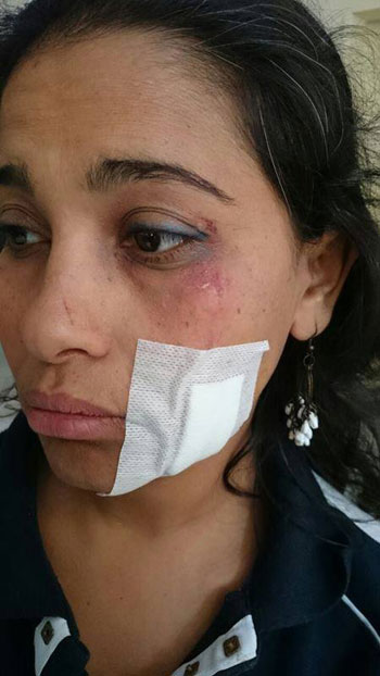المعلمة بعد اعتداء المدير عليها -اليوم السابع -5 -2015