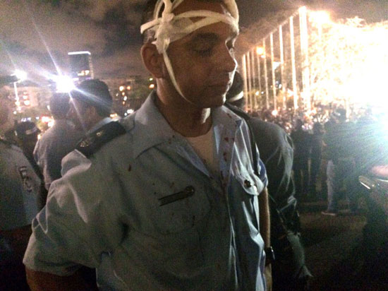 شرطى إسرائيلى مصاب من اشتباكات ميدان رابين -اليوم السابع -5 -2015