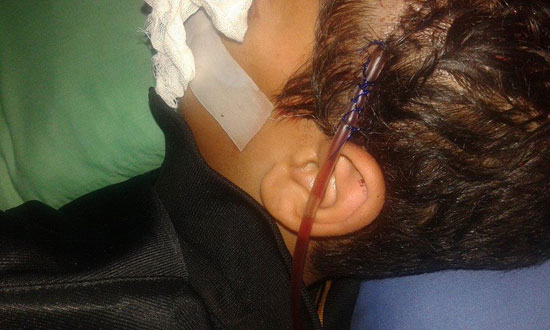 كريم أثناء إصابته بالرأس -اليوم السابع -5 -2015