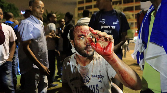 متظاهر إفريقى يغرق فى دمائه بعد استخدام الشرطة القوة المفرطة  -اليوم السابع -5 -2015
