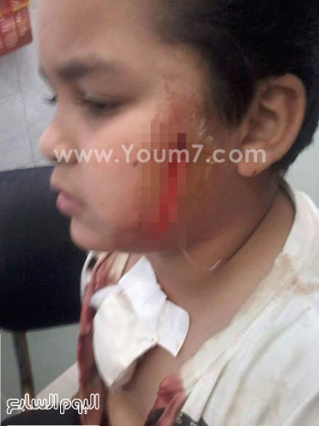 	إصابة الطالب بضربة مطواة -اليوم السابع -5 -2015