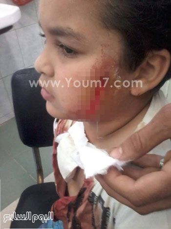 	الطالب مصاب بضربة مطواة -اليوم السابع -5 -2015