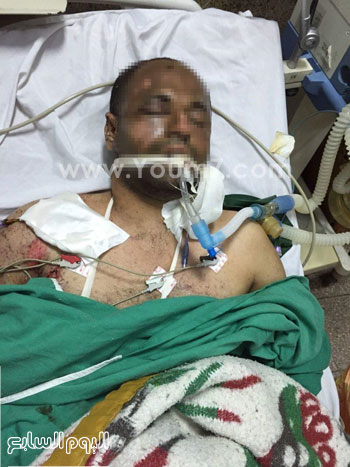 إخوانى مصاب بالمستشفى -اليوم السابع -5 -2015 إخوانى مصاب بالمستشفى -اليوم السابع -5 -2015