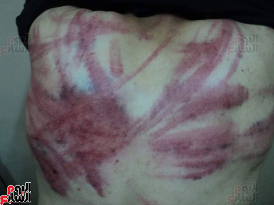 خطف وتعذيب مواطن مصرى فى مدينة سبها الليبية (1)