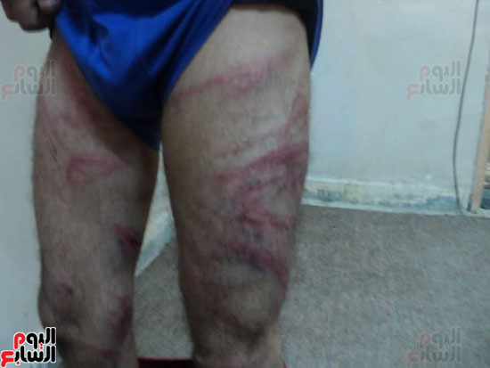 خطف وتعذيب مواطن مصرى فى مدينة سبها الليبية (2)