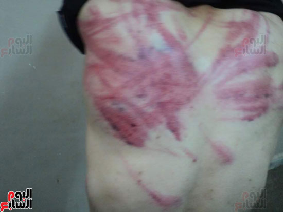 خطف وتعذيب مواطن مصرى فى مدينة سبها الليبية (3)