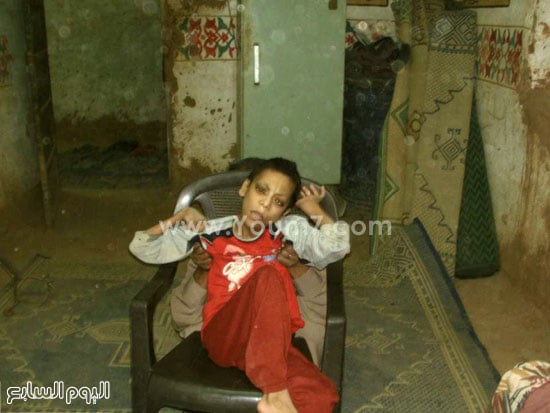 الطفل رامى لا يستطيع الحركة ويعانى من شلل فى أغلب الوظائف  -اليوم السابع -6 -2015