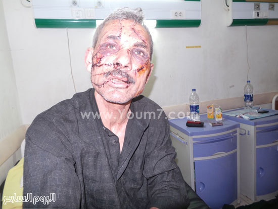 المتهمون أحدثوا إصابات بالغة فى المجنى عليه -اليوم السابع -6 -2015