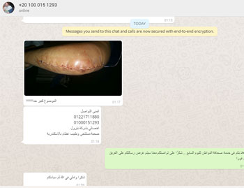  إصابة مواطن فى الإسكندرية بعجز فى يده اليسرى بسبب خطأ طبى (1)