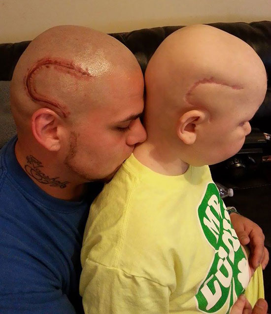 أب يحلق رأسه ويستخدم التاتو لدعم ابنه مريض السرطان (3)