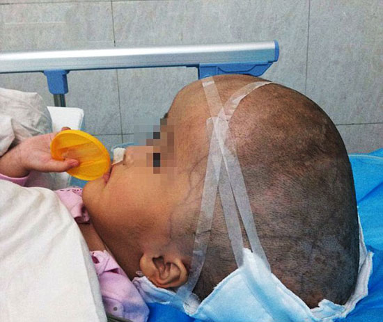 الطفل قبل إجراء الجراحة -اليوم السابع -7 -2015