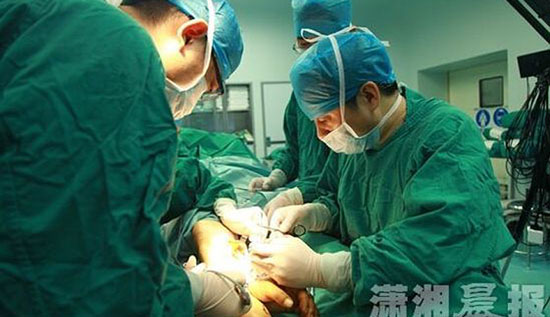 الجراحون الصينيون وهم ينفذون العملية -اليوم السابع -7 -2015