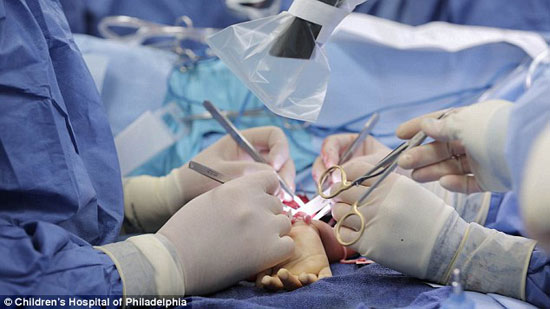 	الجراحون يجرون عملية زراعة اليدين لهارفى -اليوم السابع -7 -2015
