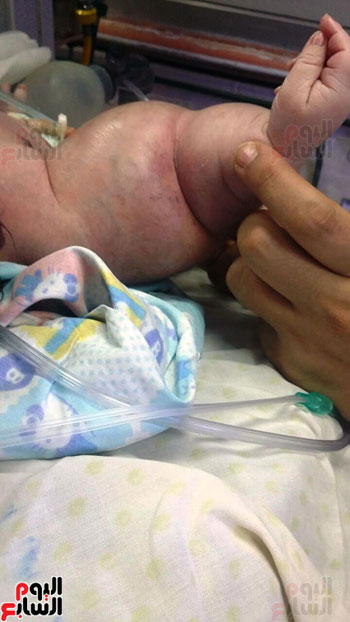 عامل يتهم أطباء بمستشفى إمبابة العام بخلع ذراع طفله أثناء الولادة (1)