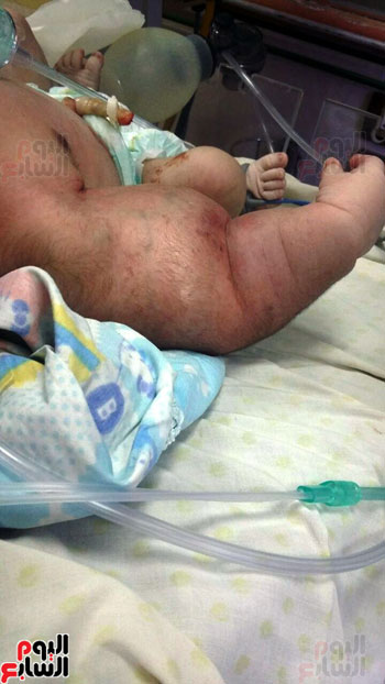 عامل يتهم أطباء بمستشفى إمبابة العام بخلع ذراع طفله أثناء الولادة (2)