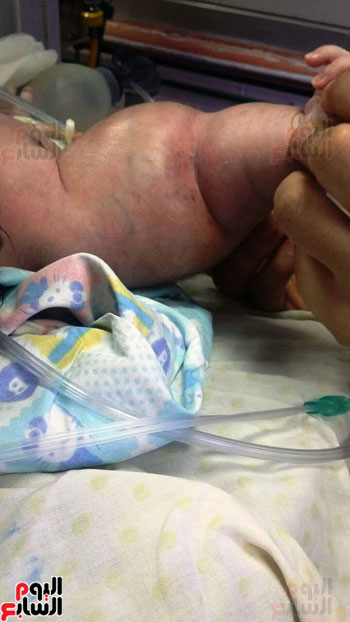 عامل يتهم أطباء بمستشفى إمبابة العام بخلع ذراع طفله أثناء الولادة (4)