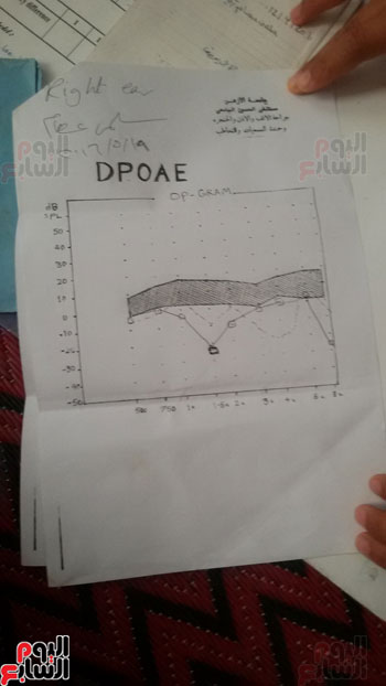 سالمة طفلة بنى سويف تعانى من فقدان كامل بالسمع والنطق (4)