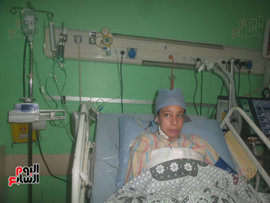 جراحة نادرة لطفلة تعانى من متلازمة مارفان (7)