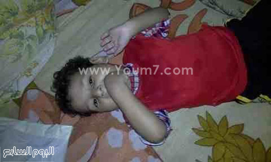 الطفل يوسف مصاب بحالة ضمور فى المخ أعجزته عن الحركة -اليوم السابع -8 -2015