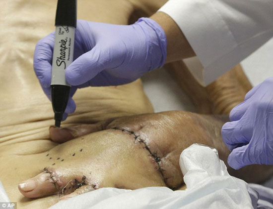 الدكتور يطمئن على المريض بعد العملية -اليوم السابع -9 -2015