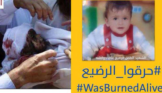 الطفل المحترق حيا على الدوابشة -اليوم السابع -9 -2015