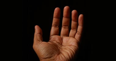 نصائح لتجنب اليدين المشققة الطقس