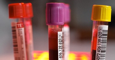 دراسة: اختبار الملاريا الحالي مفيد للتنبؤ بمخاطر فقد الدم