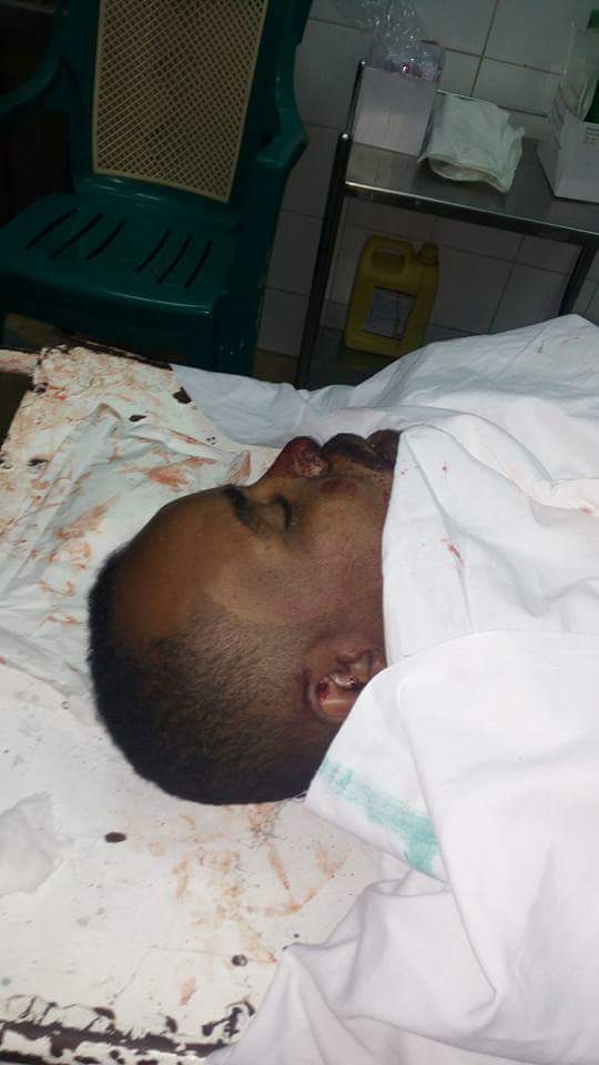 إصابة احمد عبد الوهاب بطلق نارى