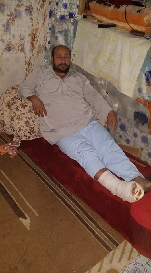 عامل المحارة طريح الفراش بمنزله بعد سقوطه اثناء عمله بالمحارة