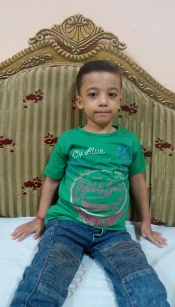 الطفل أحمد يحتاج إلى زراعة قوقعة الطفل أحمد يحتاج إلى زراعة قوقعة