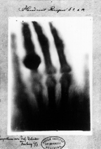 3...أول الأشعة، 1895